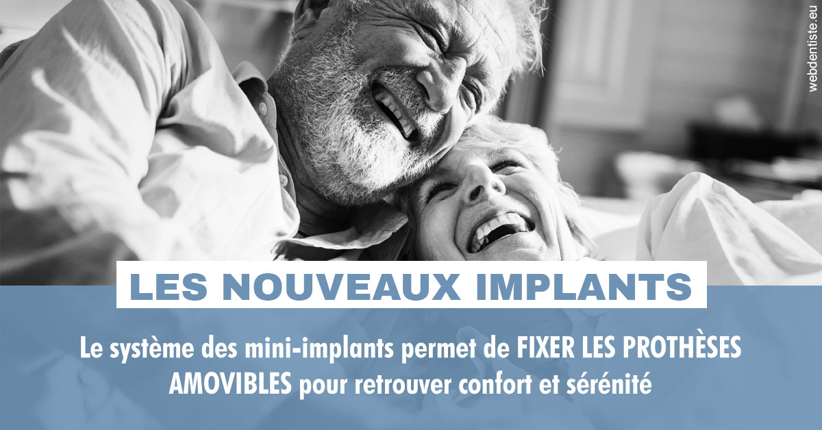https://dr-manhes-luc.chirurgiens-dentistes.fr/Les nouveaux implants 2