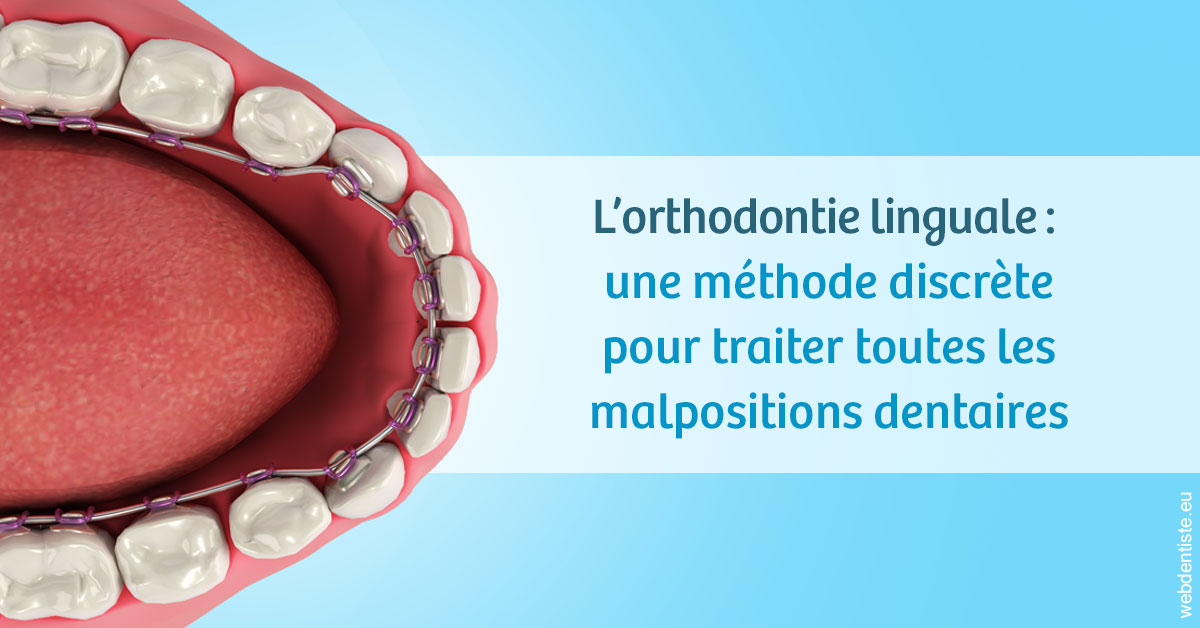 https://dr-manhes-luc.chirurgiens-dentistes.fr/L'orthodontie linguale 1