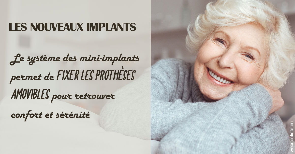 https://dr-manhes-luc.chirurgiens-dentistes.fr/Les nouveaux implants 1