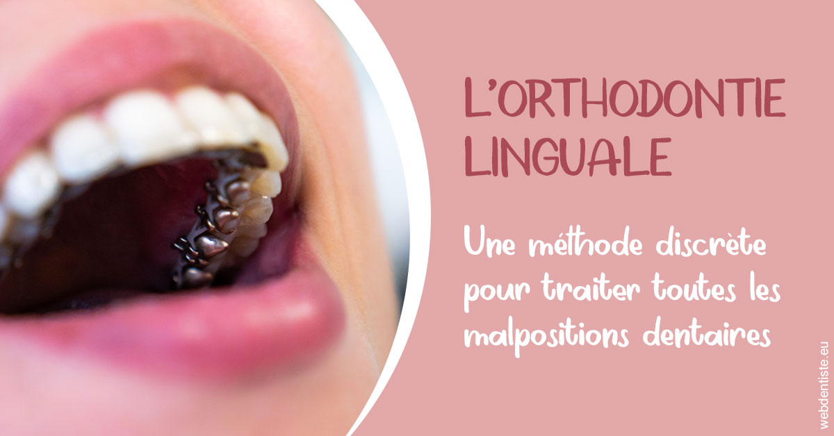 https://dr-manhes-luc.chirurgiens-dentistes.fr/L'orthodontie linguale 2
