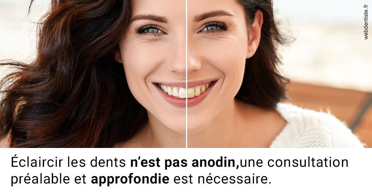 https://dr-manhes-luc.chirurgiens-dentistes.fr/Le blanchiment 2