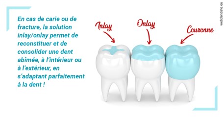 https://dr-manhes-luc.chirurgiens-dentistes.fr/L'INLAY ou l'ONLAY