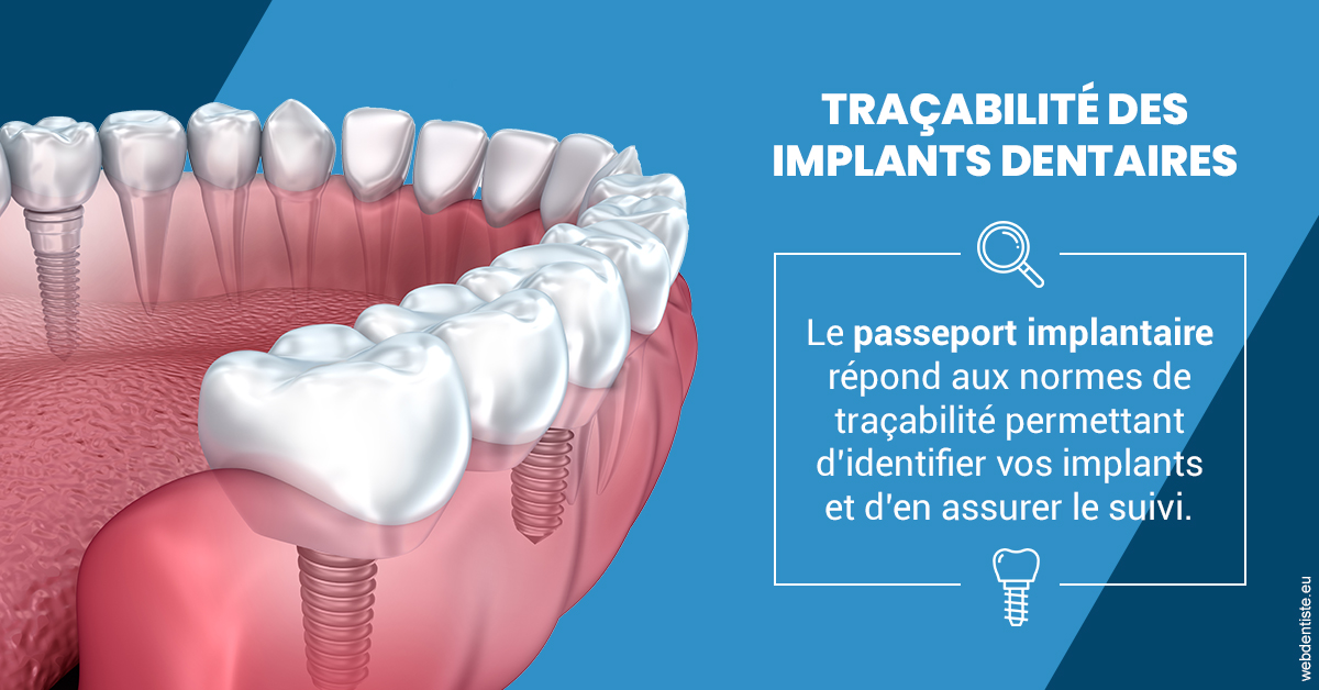 https://dr-manhes-luc.chirurgiens-dentistes.fr/T2 2023 - Traçabilité des implants 1