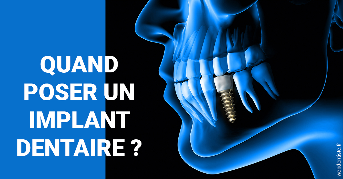https://dr-manhes-luc.chirurgiens-dentistes.fr/Les implants 1