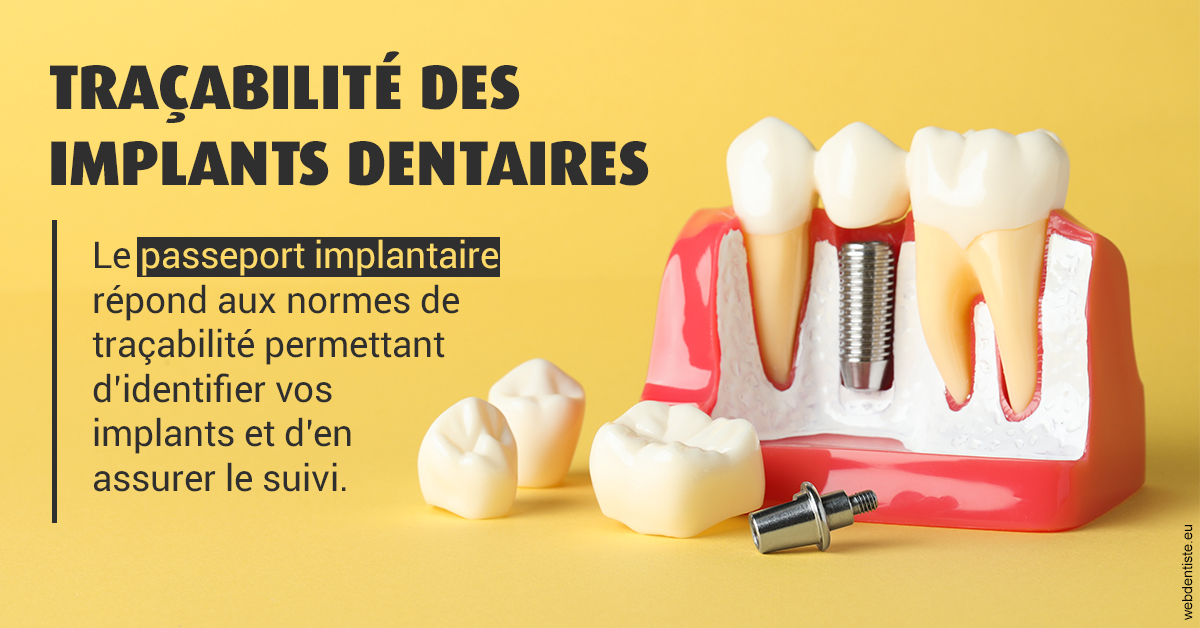 https://dr-manhes-luc.chirurgiens-dentistes.fr/T2 2023 - Traçabilité des implants 2