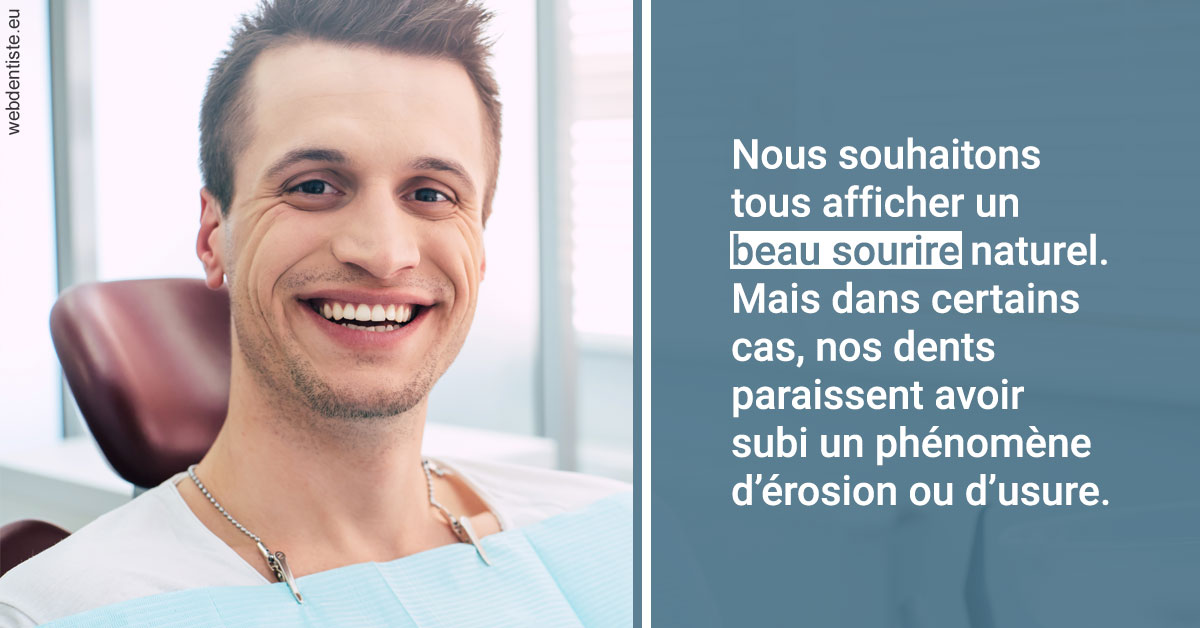 https://dr-manhes-luc.chirurgiens-dentistes.fr/Érosion et usure dentaire