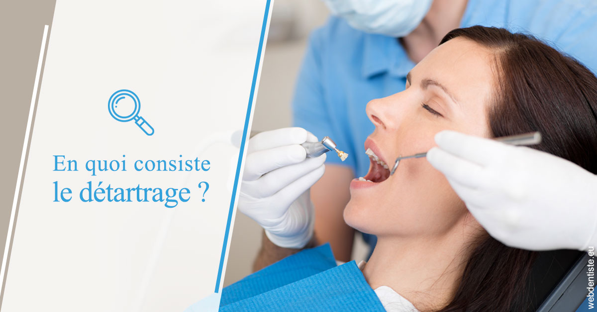 https://dr-manhes-luc.chirurgiens-dentistes.fr/En quoi consiste le détartrage