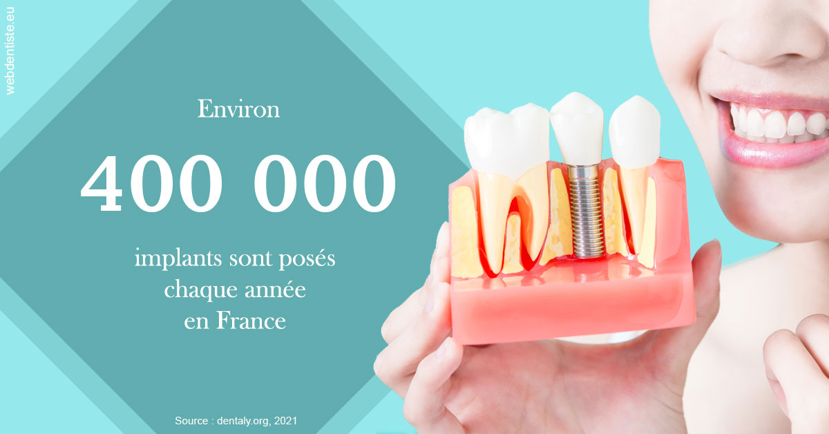 https://dr-manhes-luc.chirurgiens-dentistes.fr/Pose d'implants en France 2