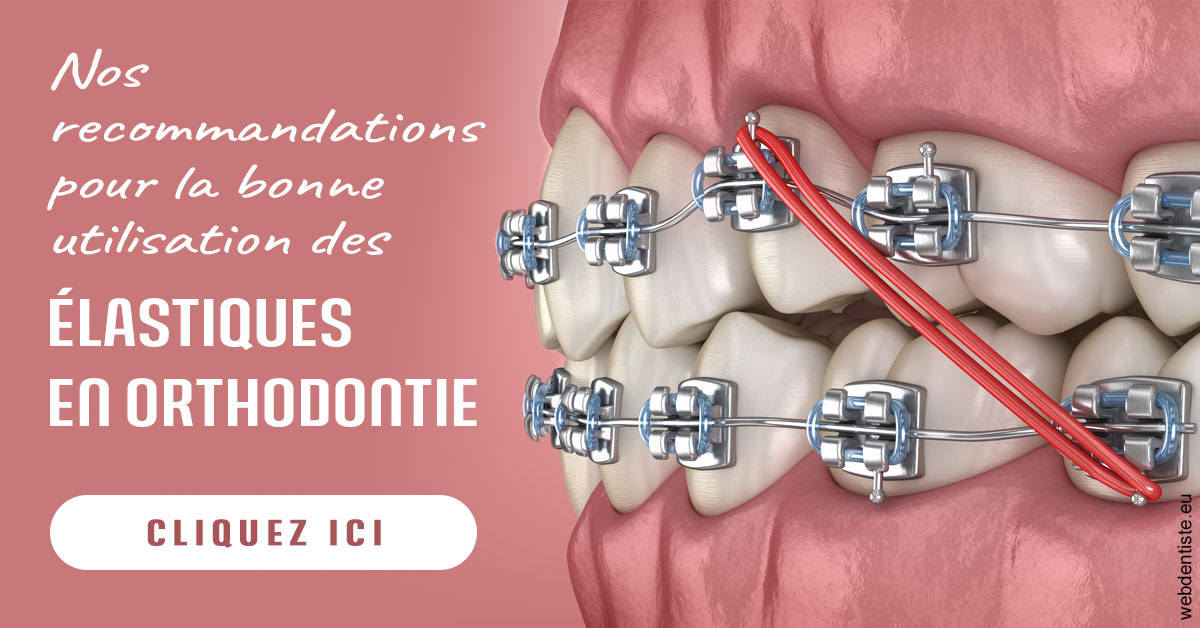 https://dr-manhes-luc.chirurgiens-dentistes.fr/Elastiques orthodontie 2